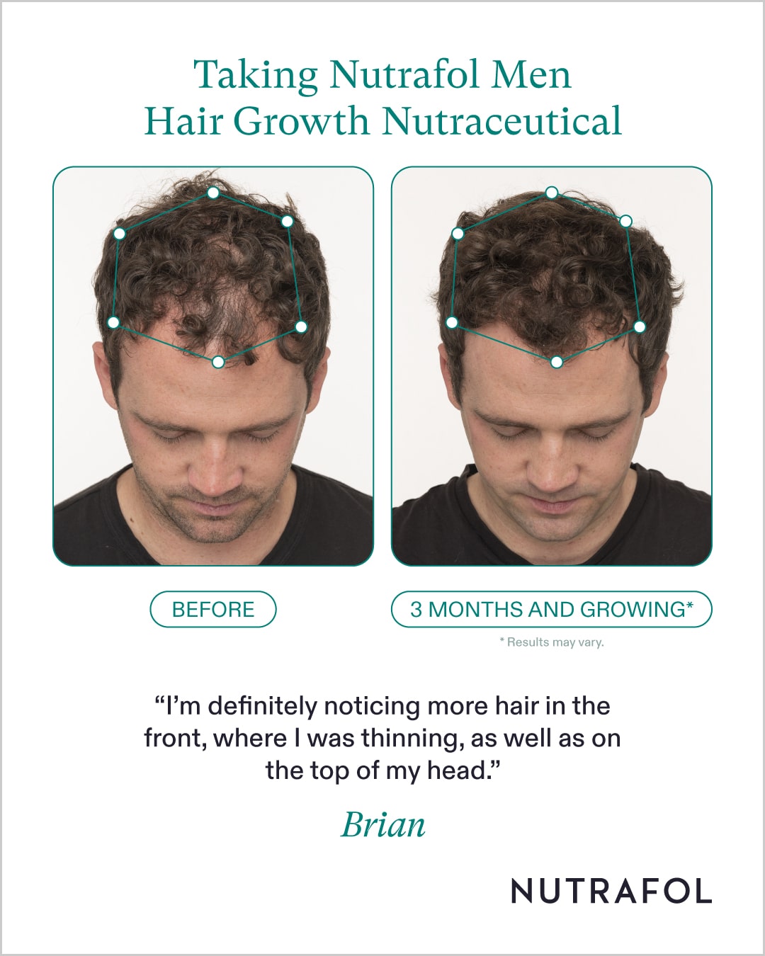 Nutrafol Men's Hair Growth Nutraceutical