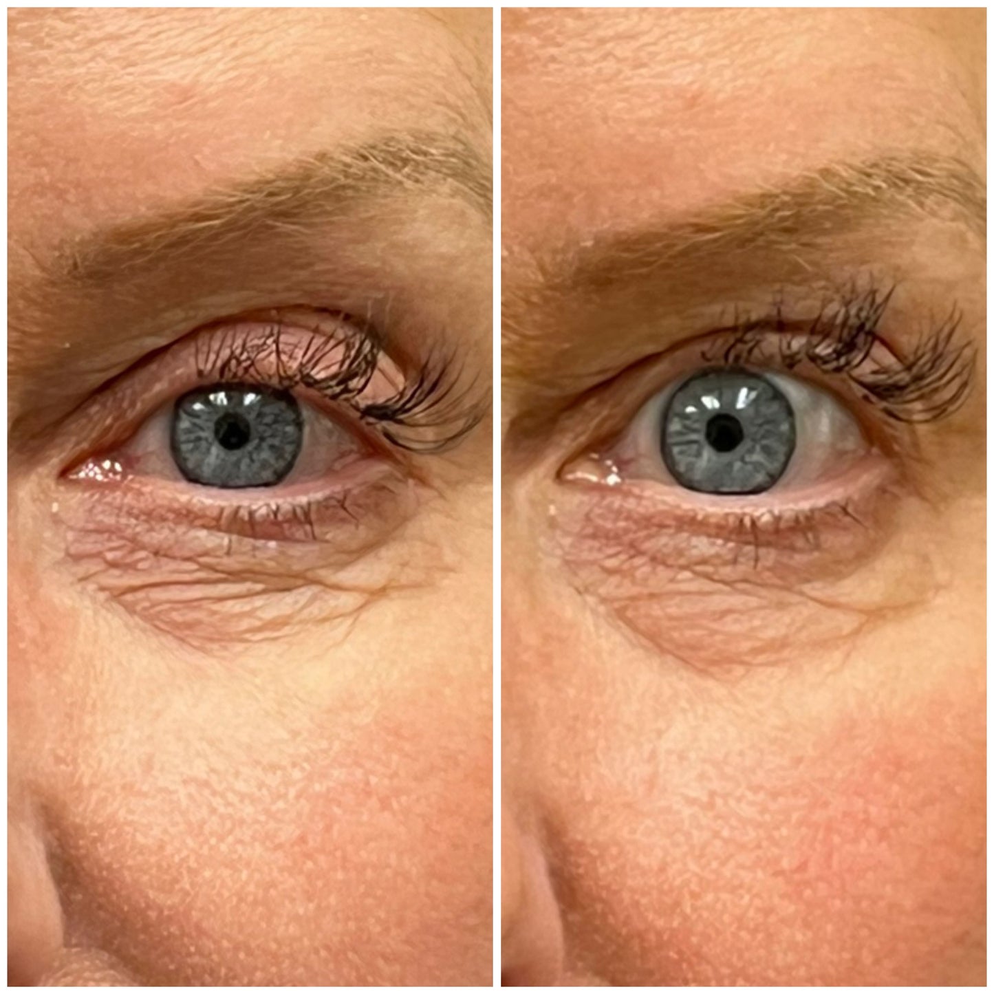 Upneez_before-after-30minutes_Brenda-
