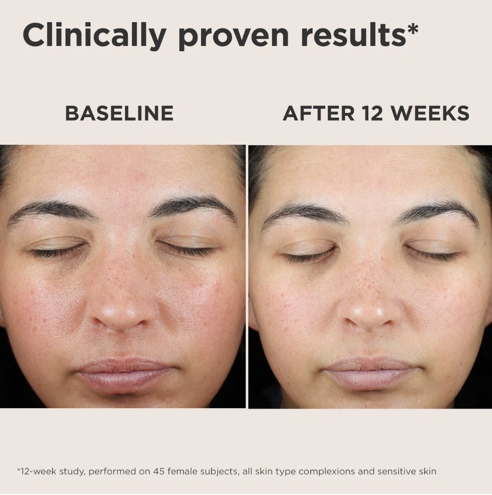 EltaMD UV Skin Recovery SPF50 Correcting Green Tint