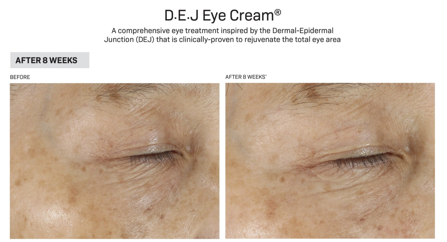 Revision-dej-eye-before-after-dca-advanced-skincare-center
