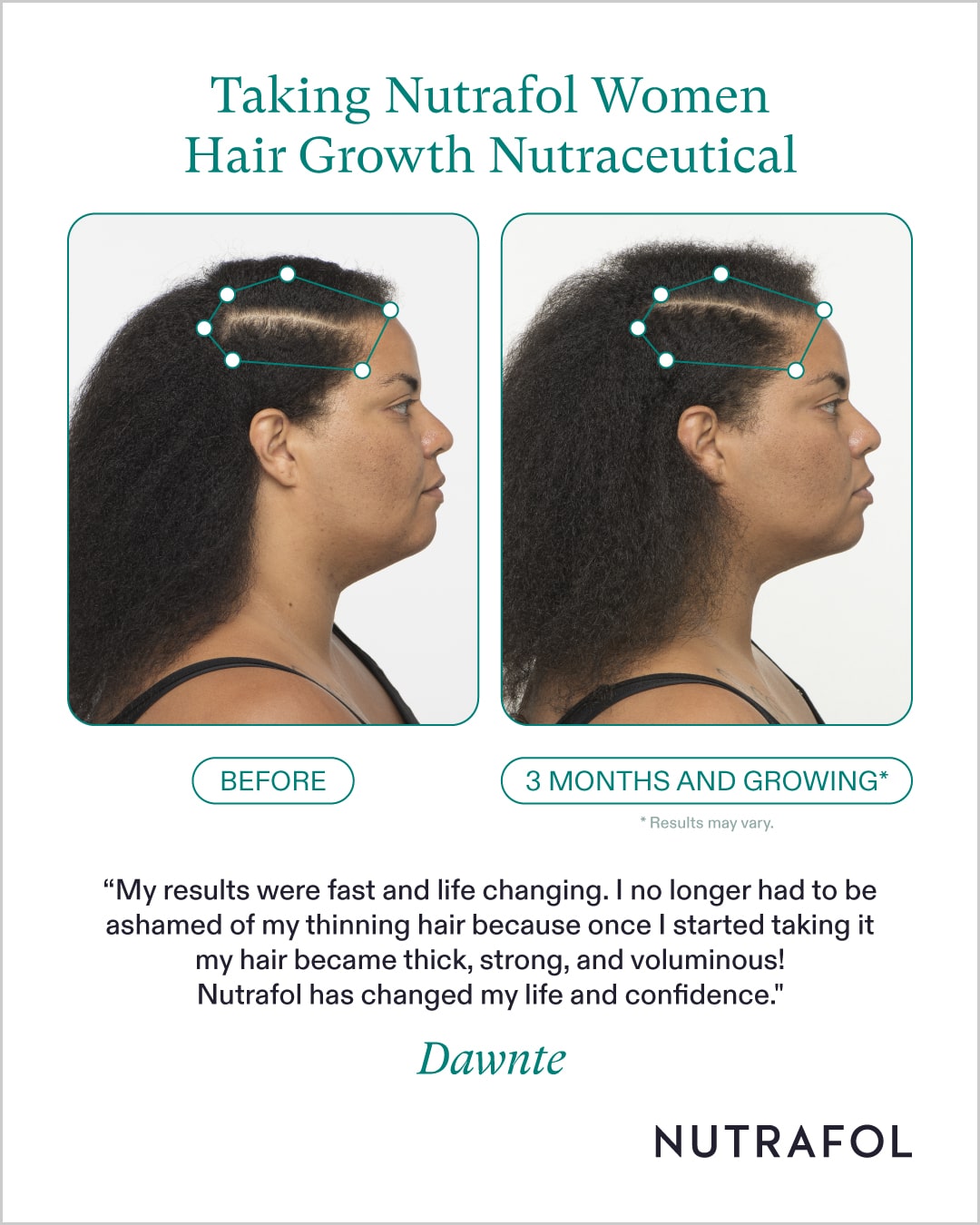 Nutrafol Women’s shops Hair Growth Pack