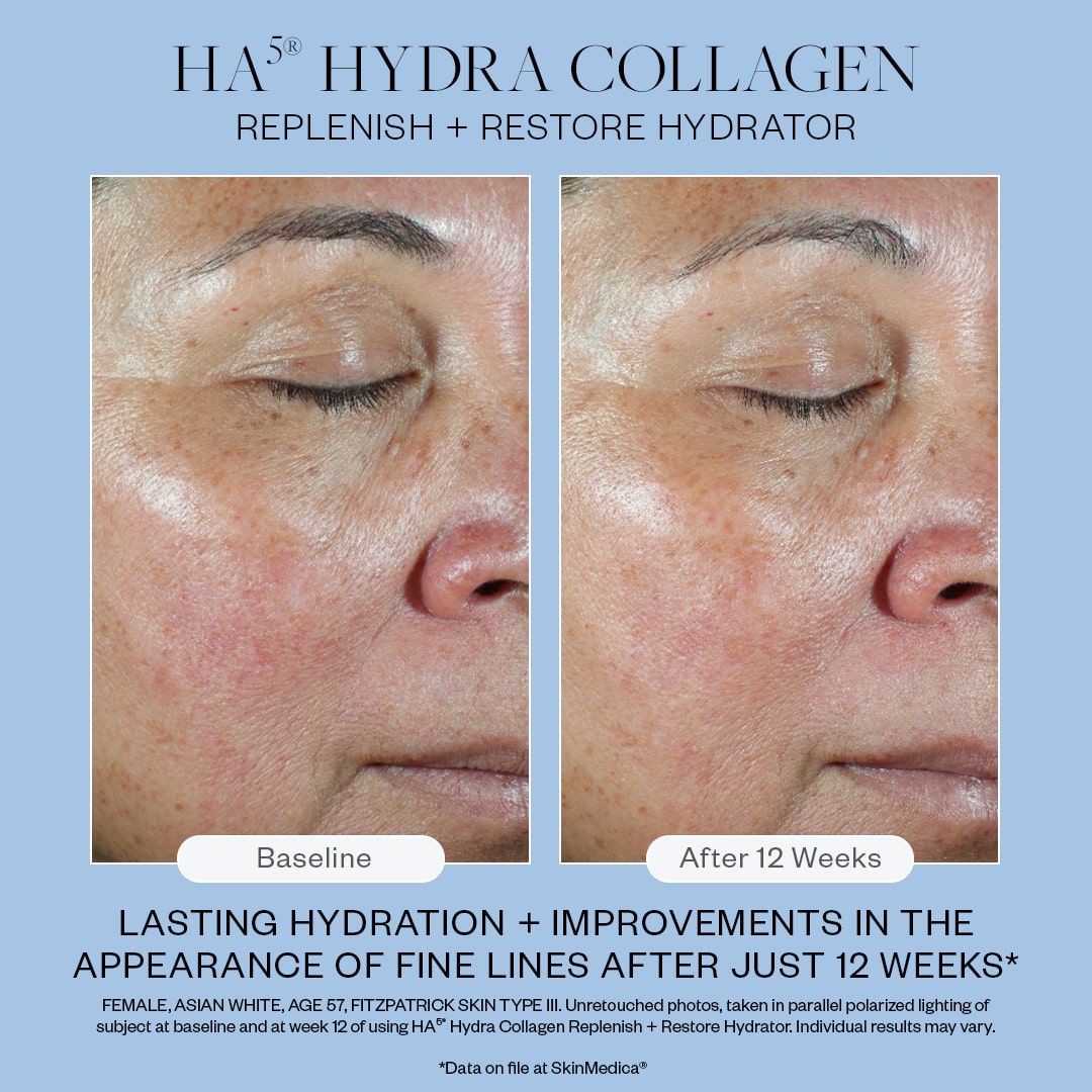 SkinMedica HA5 Hydra Collagen - NEW