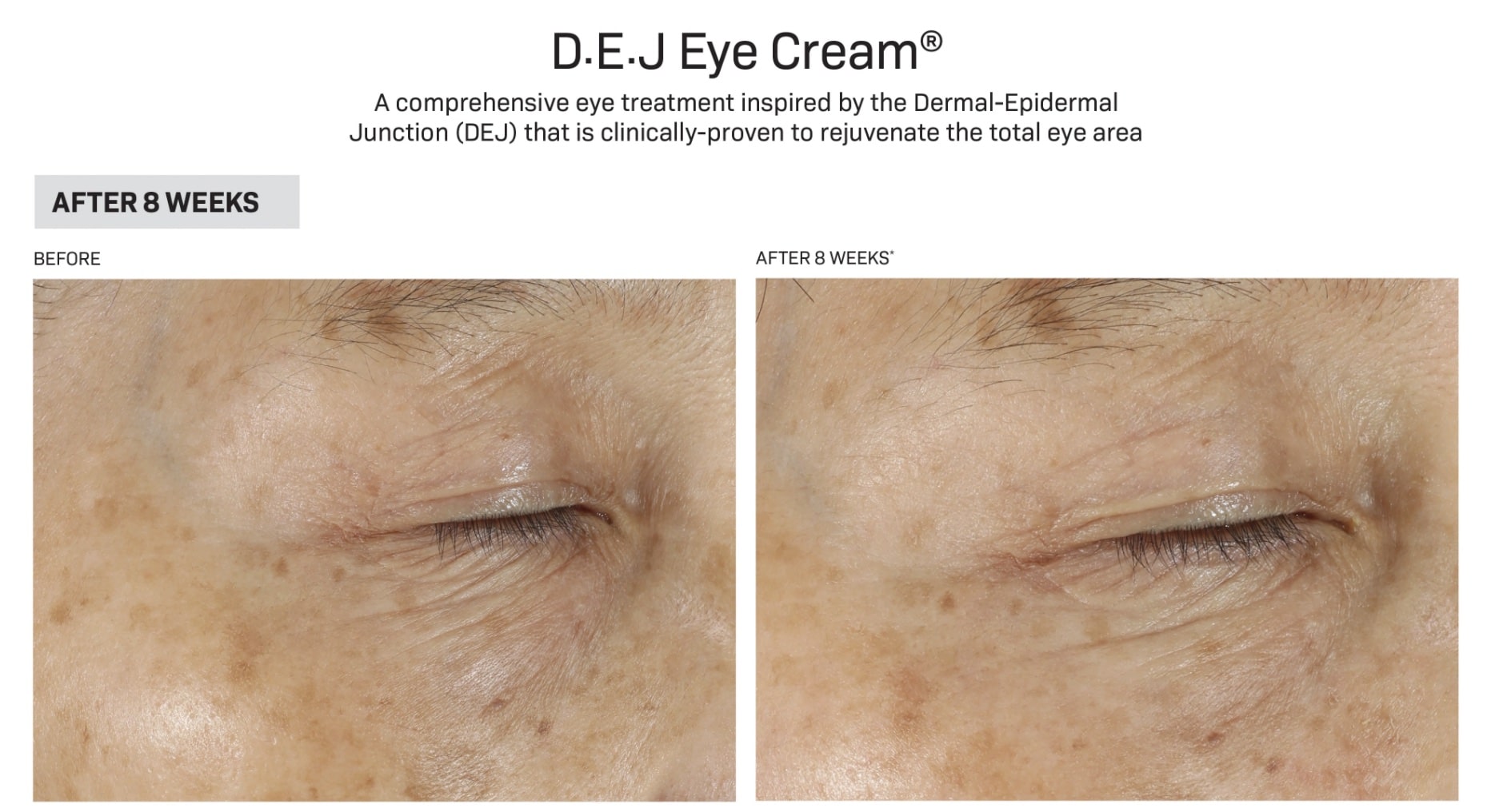Revision DEJ Eye Cream DCA Advanced SkinCare Center
