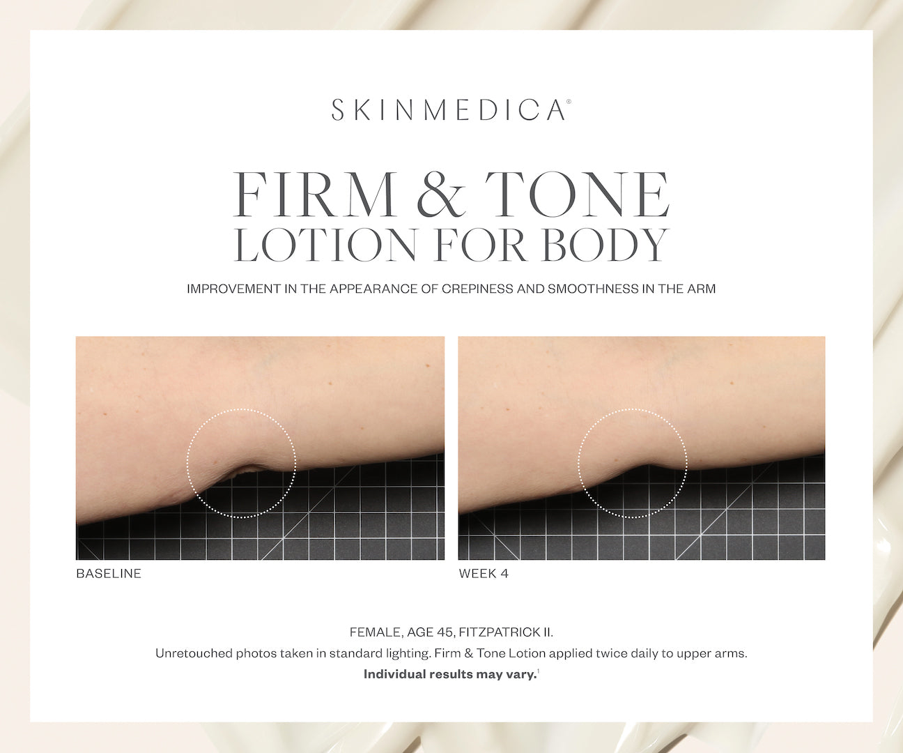 skinmedica Firm &b Tone Body Lotion Before After Upper arms DCA Advanced Skincare Store