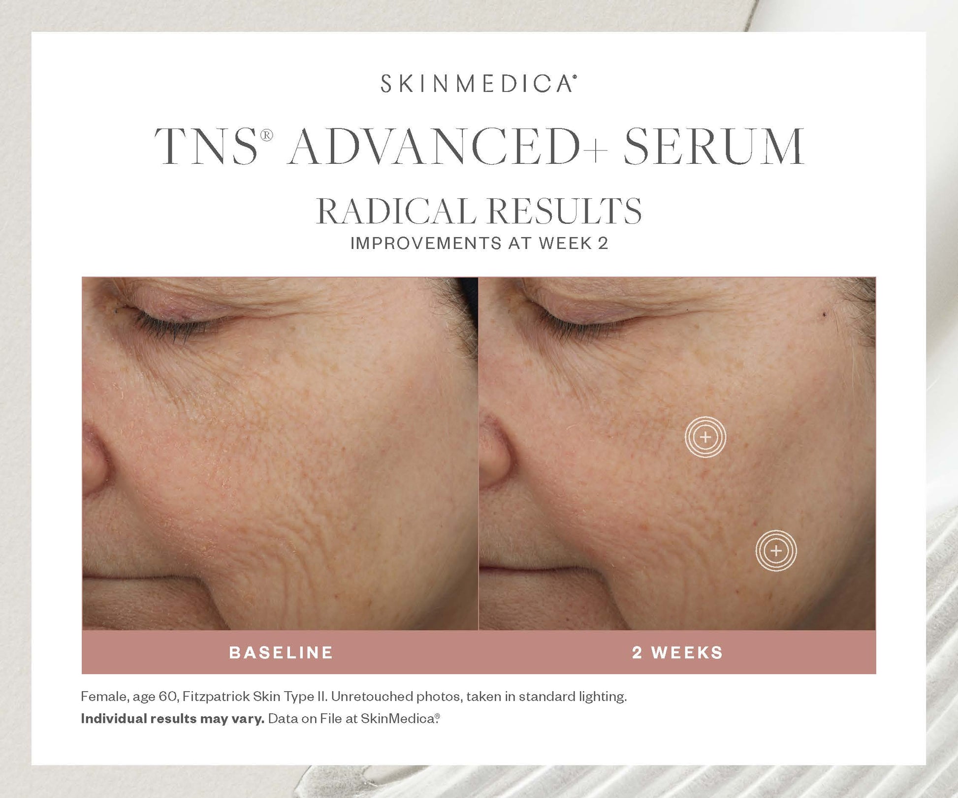 SkinMedica TNS Advanced+ Serum-before-after-dca-advanced-skincare-center